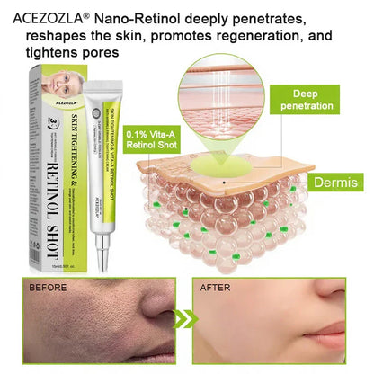 ✨Final 3 Hours: 70%OFF🔥Acezozla™ Botulinum & Vita-A Retinol Shot Wrinkle-Lift Tightening cream✨