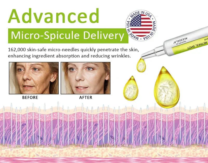 ✨Final 3 Hours: 70%OFF🔥Acezozla™ Botulinum & Vita-A Retinol Shot Wrinkle-Lift Tightening cream✨
