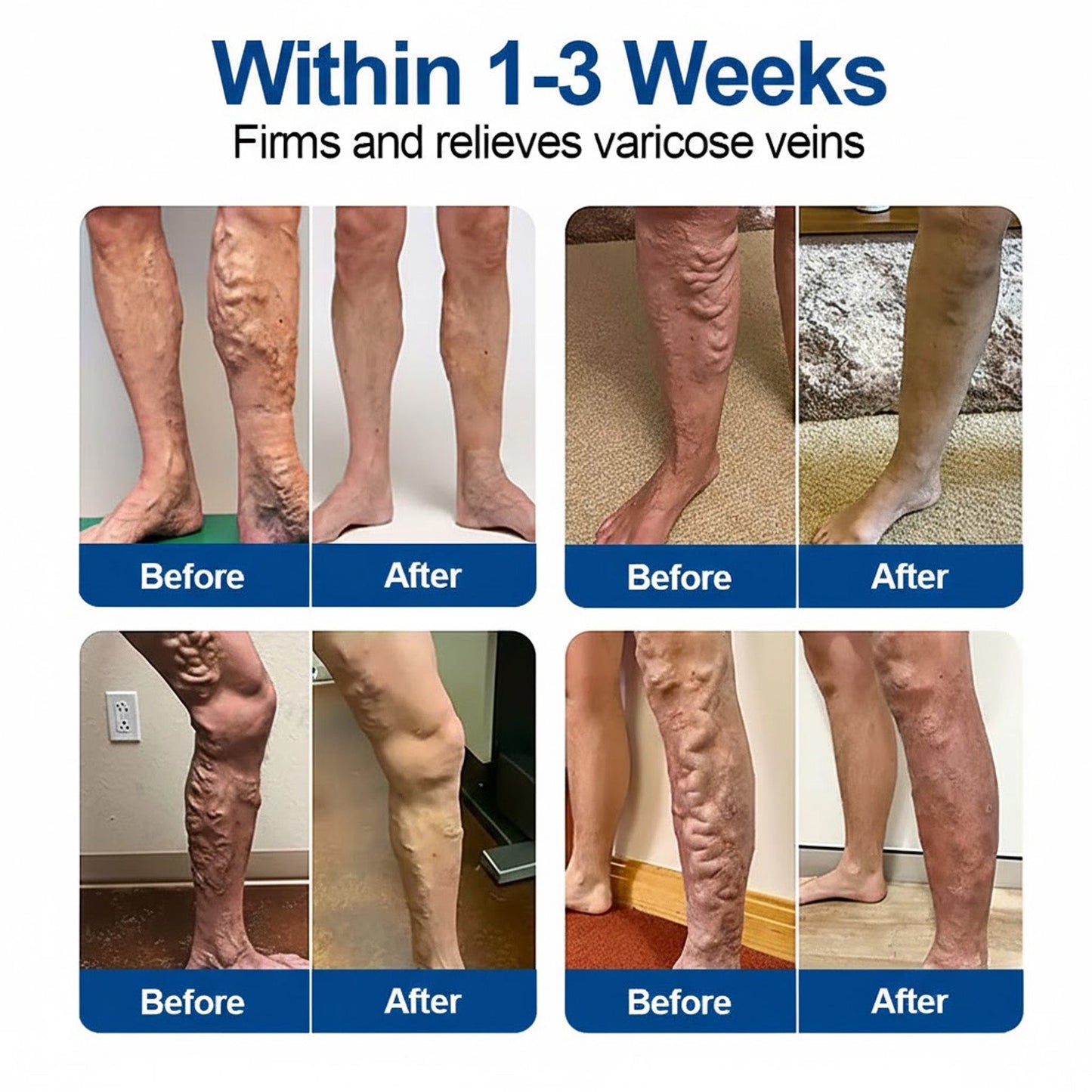👨‍⚕️Hotplex®VeinFlow Microneedle Care Patch⚡Instant Relief, Long-Term Results